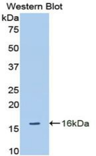 Polyclonal Antibody to A Disintegrin And Metalloproteinase With Thrombospondin 1 (ADAMTS1)