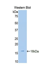 Polyclonal Antibody to A Disintegrin And Metalloproteinase With Thrombospondin 1 (ADAMTS1)