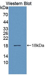 Polyclonal Antibody to A Disintegrin And Metalloproteinase With Thrombospondin 1 (ADAMTS1)