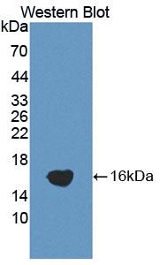 Polyclonal Antibody to A Disintegrin And Metalloproteinase With Thrombospondin 1 (ADAMTS1)