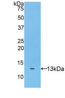 Polyclonal Antibody to A Disintegrin And Metalloproteinase With Thrombospondin 7 (ADAMTS7)