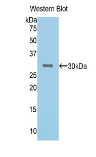 Polyclonal Antibody to Complement Factor I (CFI)