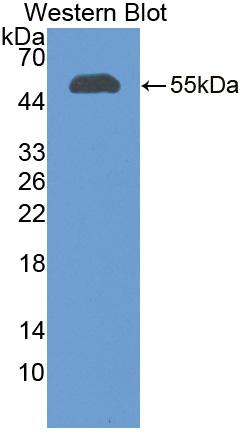 Polyclonal Antibody to Complement Factor I (CFI)