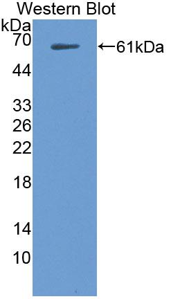 Polyclonal Antibody to Tau-Protein Kinase 1 (tPK1)