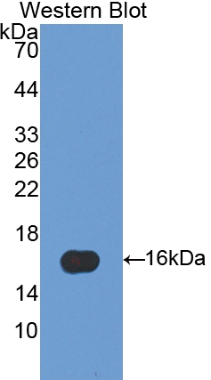 Polyclonal Antibody to Fatty Acid Binding Protein 5 (FABP5)