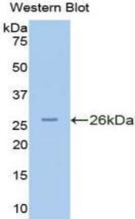 Polyclonal Antibody to Protein Kinase N2 (PKN2)