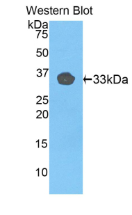 Polyclonal Antibody to Toll Like Receptor 1 (TLR1)