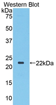 Polyclonal Antibody to Toll Like Receptor 3 (TLR3)