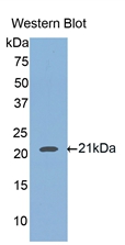 Polyclonal Antibody to Hemojuvelin (HJV)