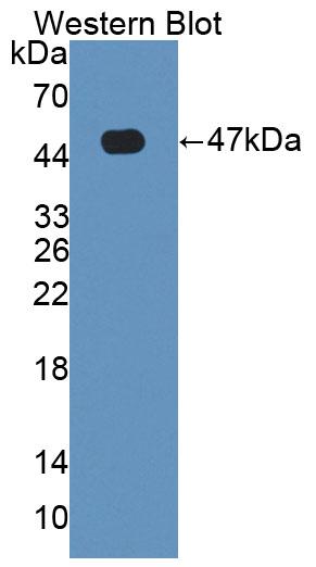 Polyclonal Antibody to Hemojuvelin (HJV)