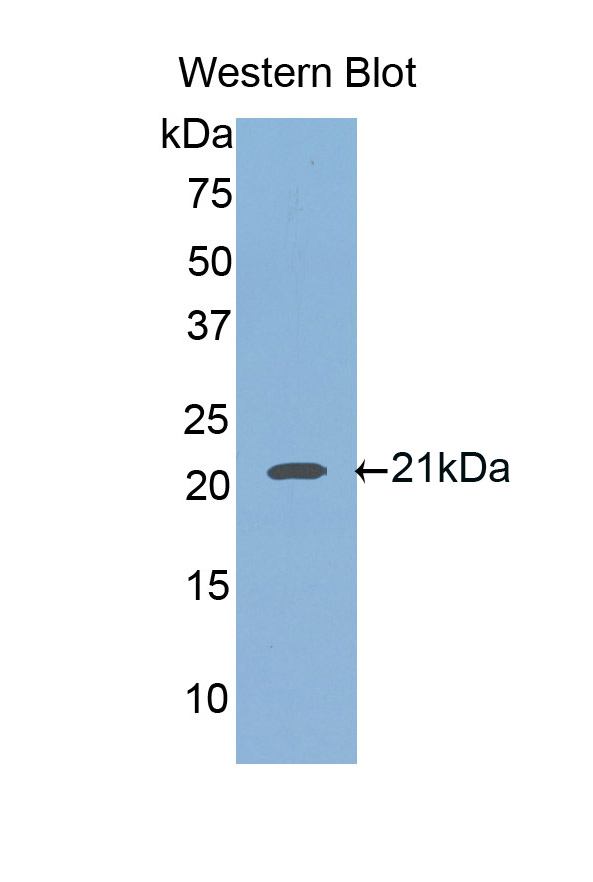 FITC-Linked Polyclonal Antibody to Hemojuvelin (HJV)