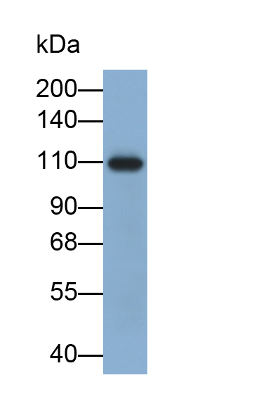 PAB998Hu01.jpg