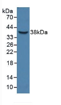 Polyclonal Antibody to Haptoglobin Related Protein (HPR)