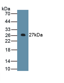 Polyclonal Antibody to Apolipoprotein B (APOB)