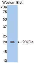 Polyclonal Antibody to Apolipoprotein B (APOB)