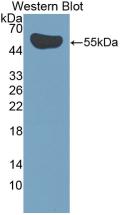 Polyclonal Antibody to Interleukin 35 (IL35)