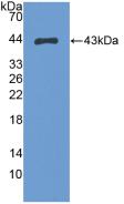 Polyclonal Antibody to S100 Calcium Binding Protein A2 (S100A2)