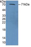 Polyclonal Antibody to Serpin A10 (SERPINA10)