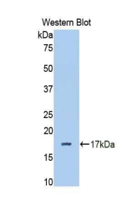 Polyclonal Antibody to Complement Factor B (CFB)