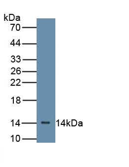 Polyclonal Antibody to Complement Factor B (CFB)