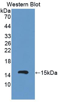 Polyclonal Antibody to Complement Factor B (CFB)