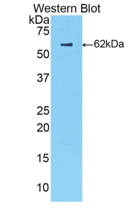 Polyclonal Antibody to Complement Factor B (CFB)