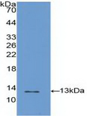 Polyclonal Antibody to S100 Calcium Binding Protein A4 (S100A4)