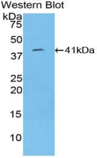 Polyclonal Antibody to Cytokeratin 8 (CK8)