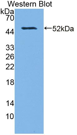 Polyclonal Antibody to O-6-Methylguanine DNA Methyltransferase (MGMT)