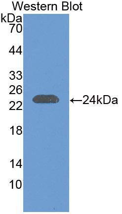 PAC029Hu01.jpg