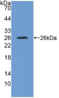 Polyclonal Antibody to Interleukin 4 Receptor (IL4R)