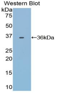 Polyclonal Antibody to Transferrin (TF)