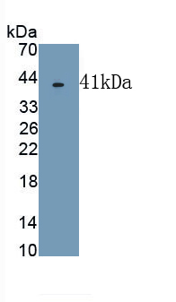 Polyclonal Antibody to Transferrin (TF)