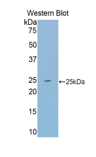 Polyclonal Antibody to Transferrin (TF)