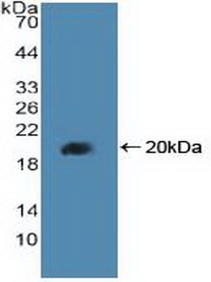 Polyclonal Antibody to Peroxisome Proliferator Activated Receptor Delta (PPARd)