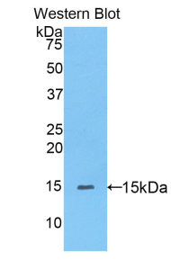 Polyclonal Antibody to Peroxisome Proliferator Activated Receptor Delta (PPARd)