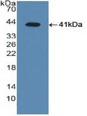 Polyclonal Antibody to Liver X Receptor Alpha (LXRa)