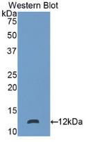 Polyclonal Antibody to S100 Calcium Binding Protein P (S100P)