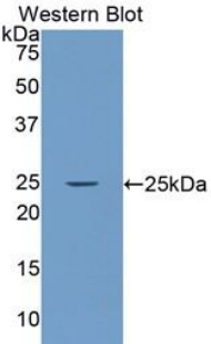 Polyclonal Antibody to Laminin Alpha 4 (LAMa4)