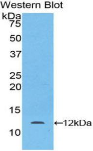 Polyclonal Antibody to Laminin Beta 2 (LAMb2)