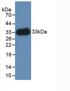 Polyclonal Antibody to Laminin Gamma 1 (LAMC1)