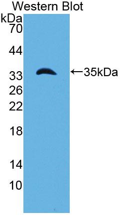 Polyclonal Antibody to Laminin Gamma 1 (LAMC1)