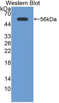 Polyclonal Antibody to Laminin Gamma 2 (LAMC2)