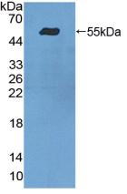 Polyclonal Antibody to Integrin Alpha 9 (ITGa9)