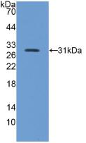 Polyclonal Antibody to Integrin Beta 5 (ITGb5)