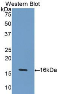 Polyclonal Antibody to Growth Differentiation Factor 5 (GDF5)