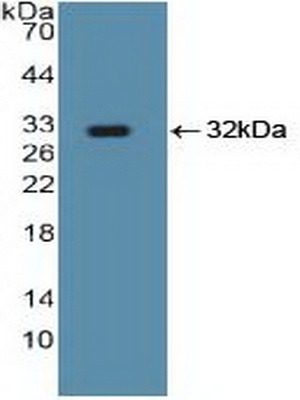 Polyclonal Antibody to SMAD family member 5 (SMAD5)