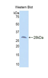 Polyclonal Antibody to SMAD family member 3 (SMAD3)