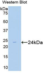 Polyclonal Antibody to Mothers Against Decapentaplegic Homolog 2 (Smad2)