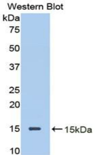 Polyclonal Antibody to Decorin (DCN)